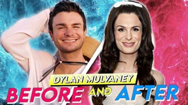 Dylan Mulvaney Before And After Side By Side
